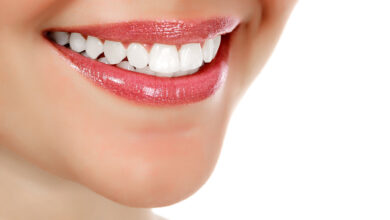 Photo of Teeth Whitening and Maintenance Solutions That Won’t Break the Bank