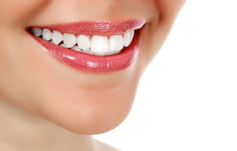 Teeth Whitening