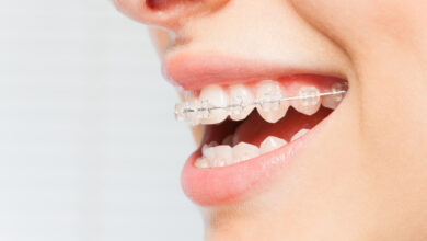 Photo of What Is the Quickest Way to Straighten Teeth?