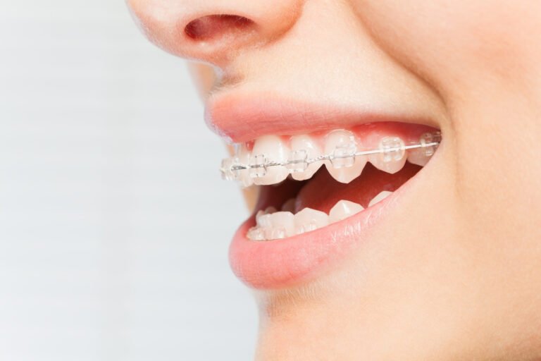 Teeth