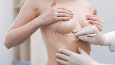 Photo of Recovery Tips for a Breast Implant Procedure