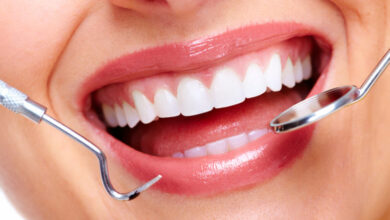 Photo of Affordable Dental Options for Common Dental Procedures
