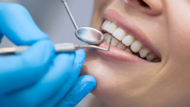 Photo of How to Choose the Best Implant Dentist Near Me