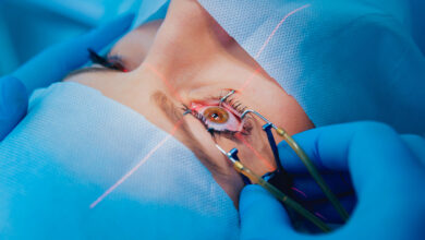 Photo of How Long Does LASIK Surgery Take? A Quick Guide