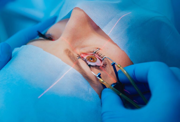 how long does lasik surgery take