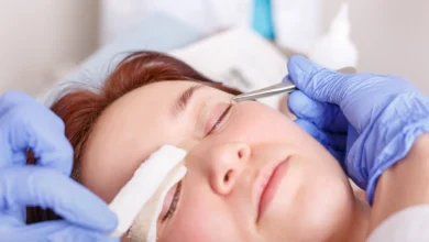 Photo of How to Get Insurance to Pay for Eyelid Surgery