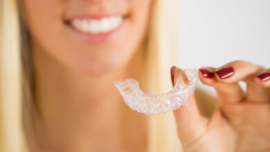 Photo of Your Guide to Invisalign Attachments
