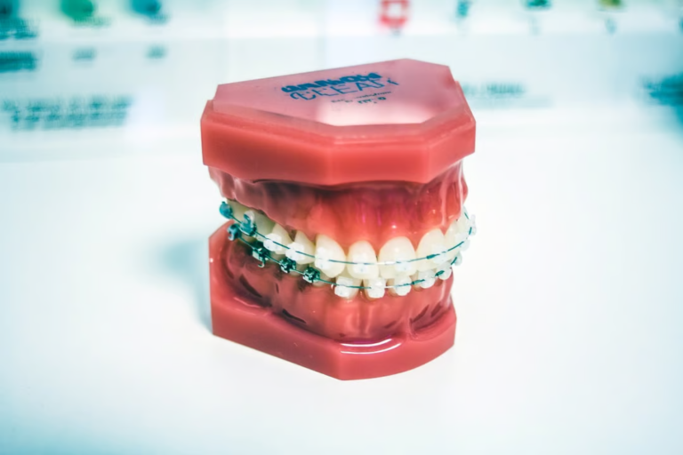 severe underbite
